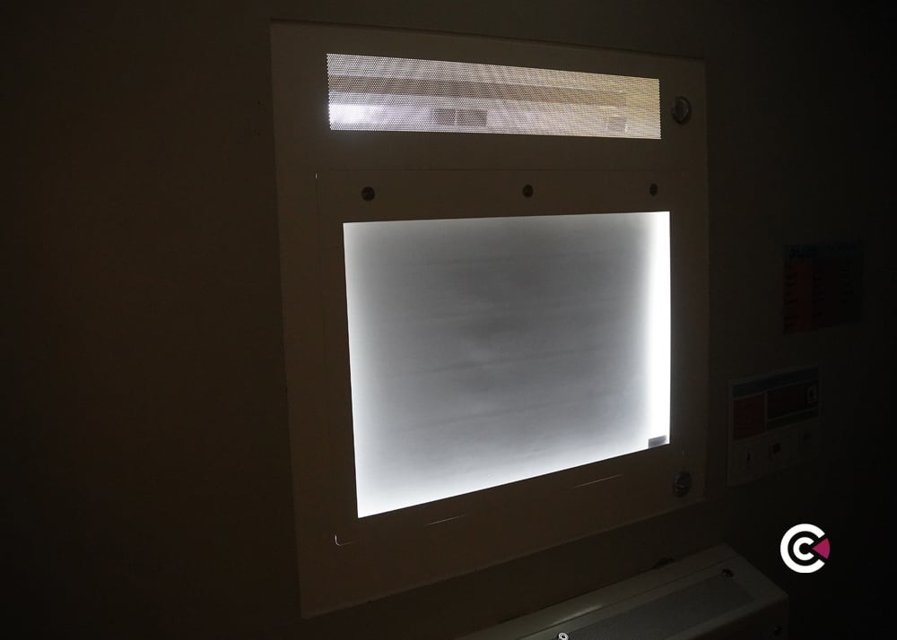 blackout blind for mental health